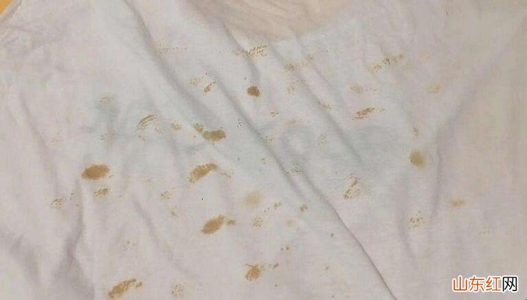 白色衣服泛黄还能穿吗