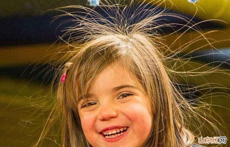 有哪些去头发静电小妙招