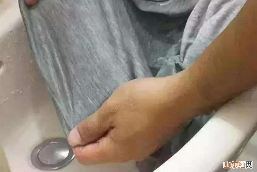 衣服沾上红药水了怎样才能洗掉